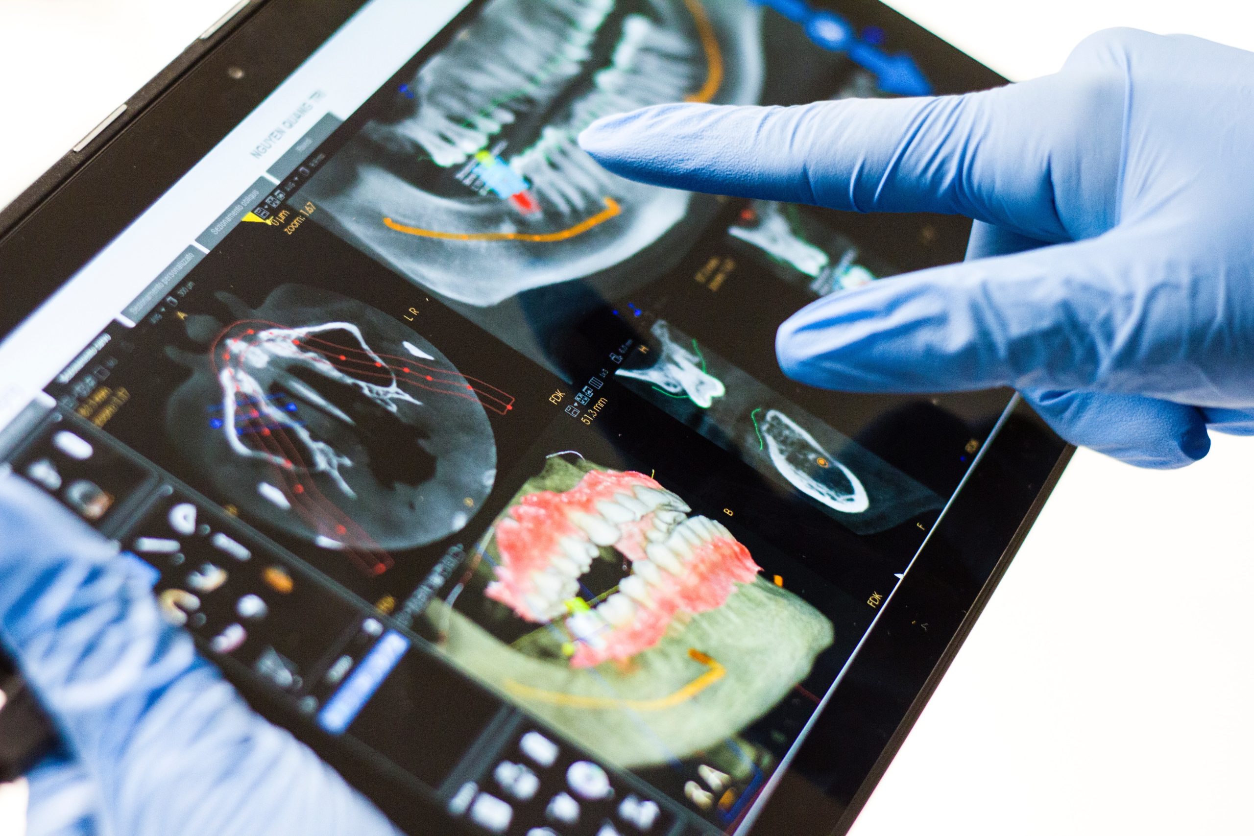 CBCT & Radilogy Protocol for Implant Diagnosis